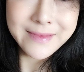 40대~ 리프팅, 지방이식 네달차